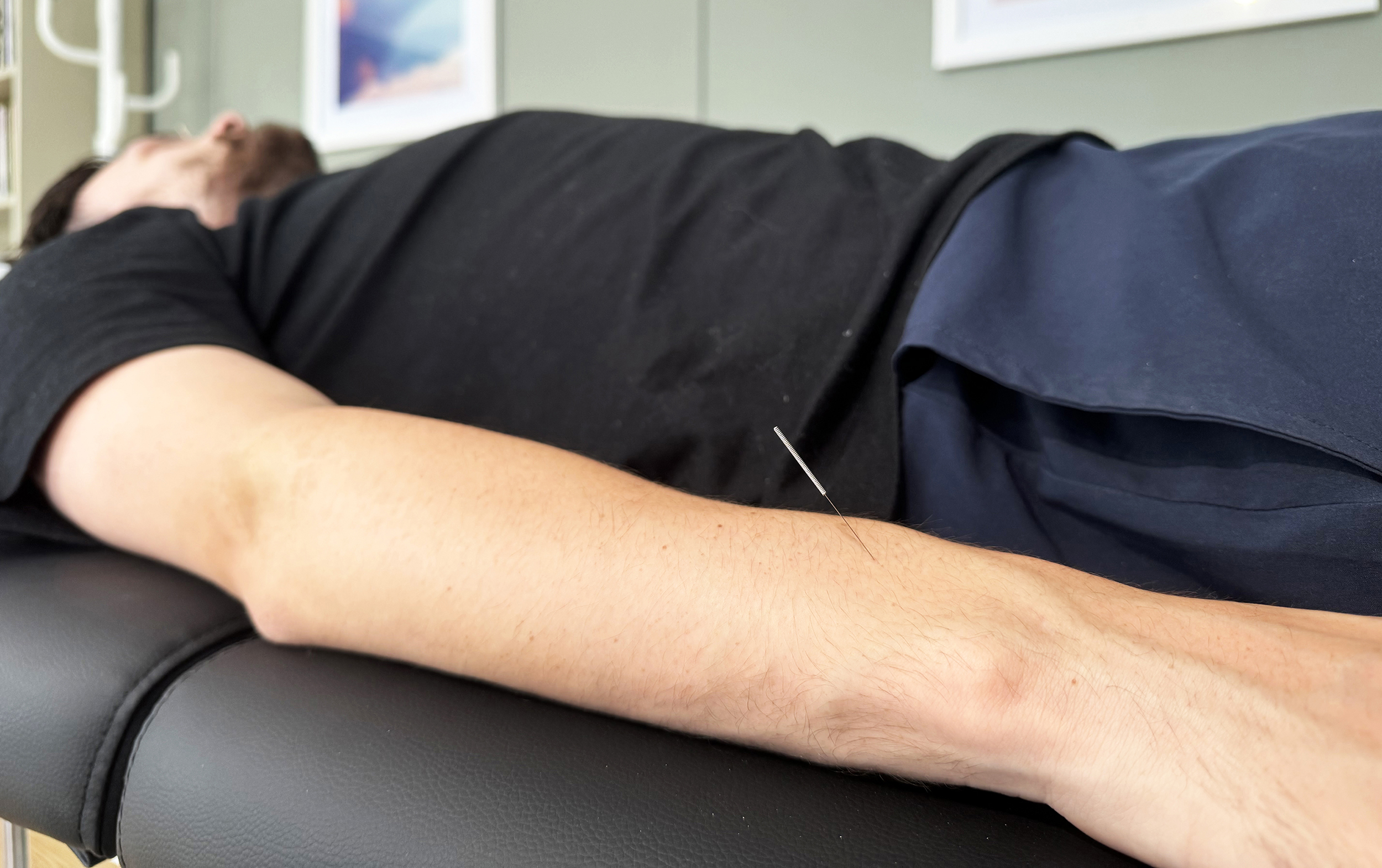 Acupuncture in Saffron Walden