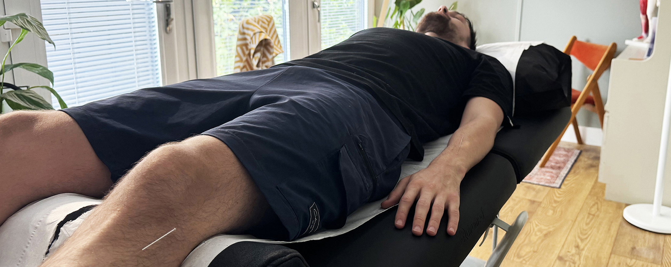 Acupuncture in Saffron Walden by Vanessa Acupuncture